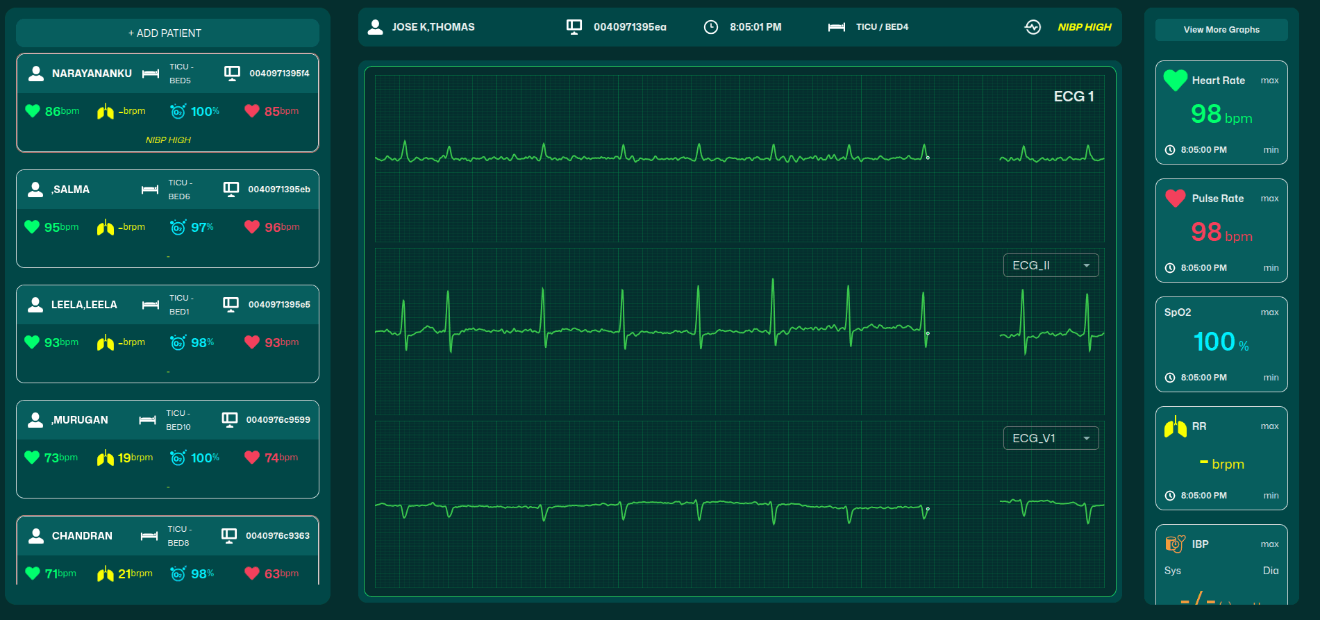 Real-Time ECG Monitoring & Visualization Platform graph screenshot